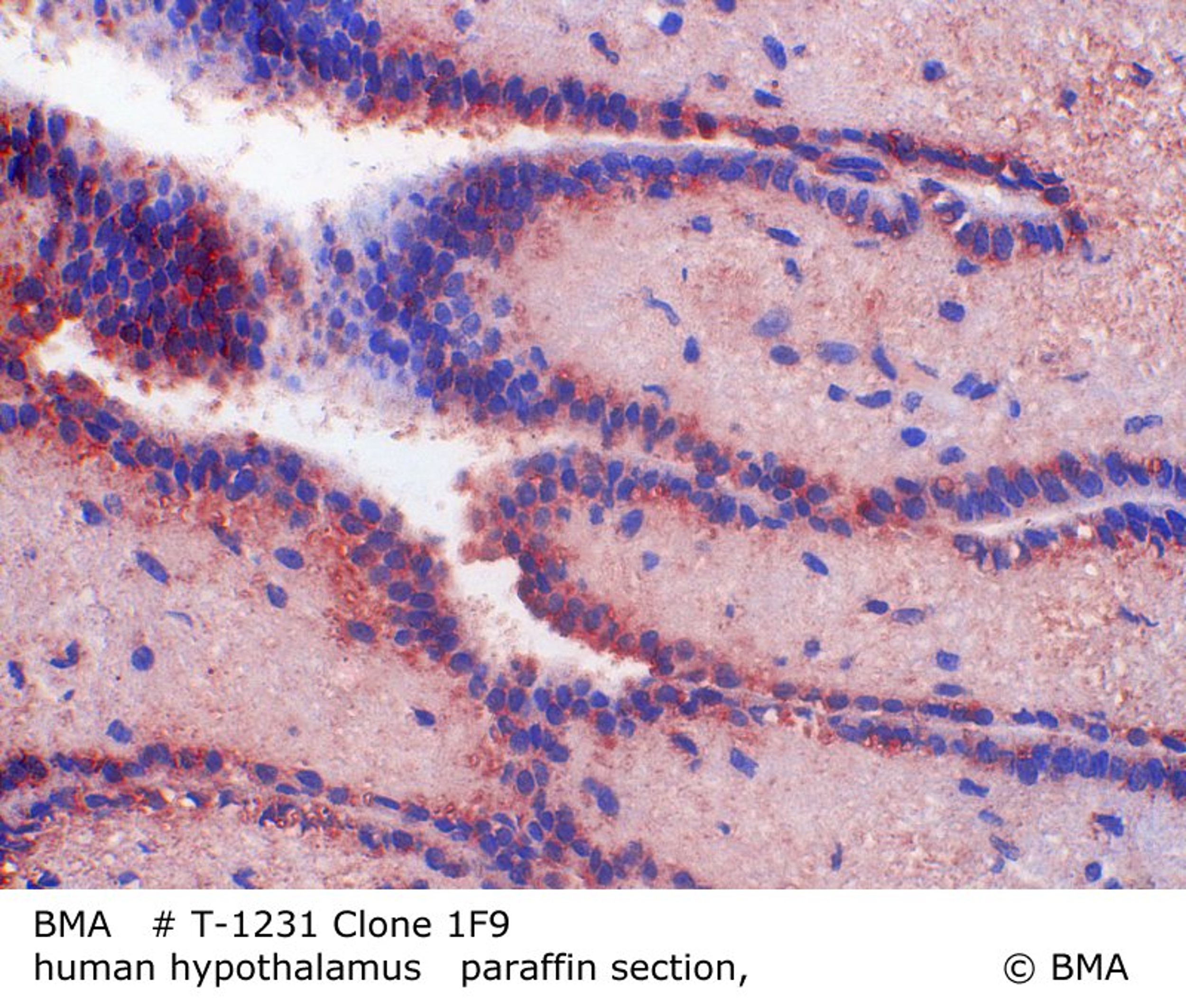 Antibody T-1231