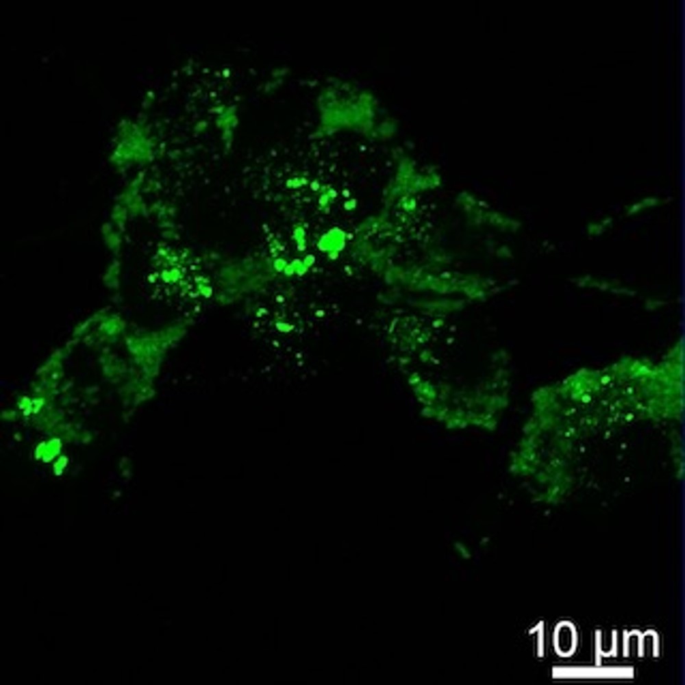 Human Recombinant Alpha-Synuclein PFF labeled with Alexa Fluor 488