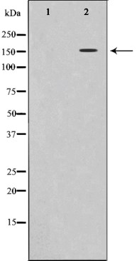 Phospho-VEGFR2 (Tyr1214) Antibody