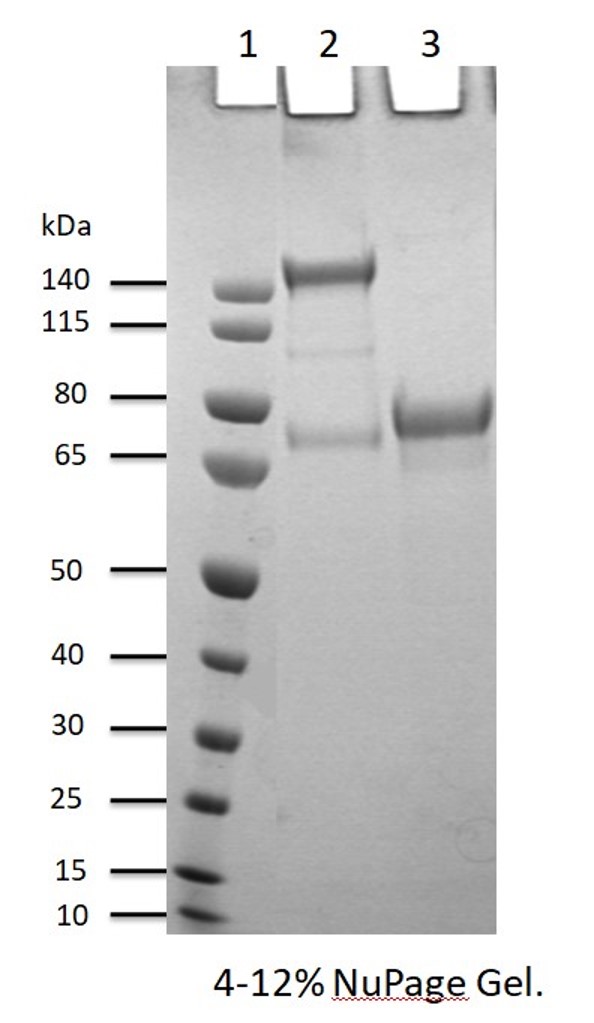 Recombinant Human DDR1-Fc Protein