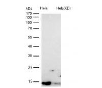 DYNLL1 Rabbit mAb