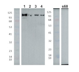 Agrisera 공식대리점 관련 업무대행/수입- Anti-AARE 제품소개