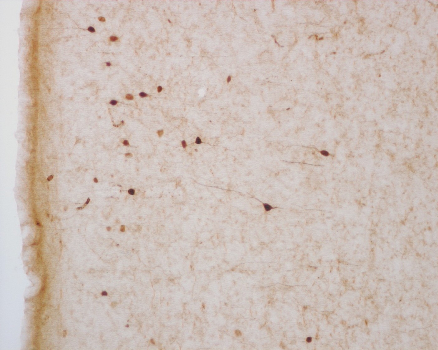 CR6B3 - Calretinin-200uL