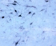 Fluorochrome 한국공식대리점