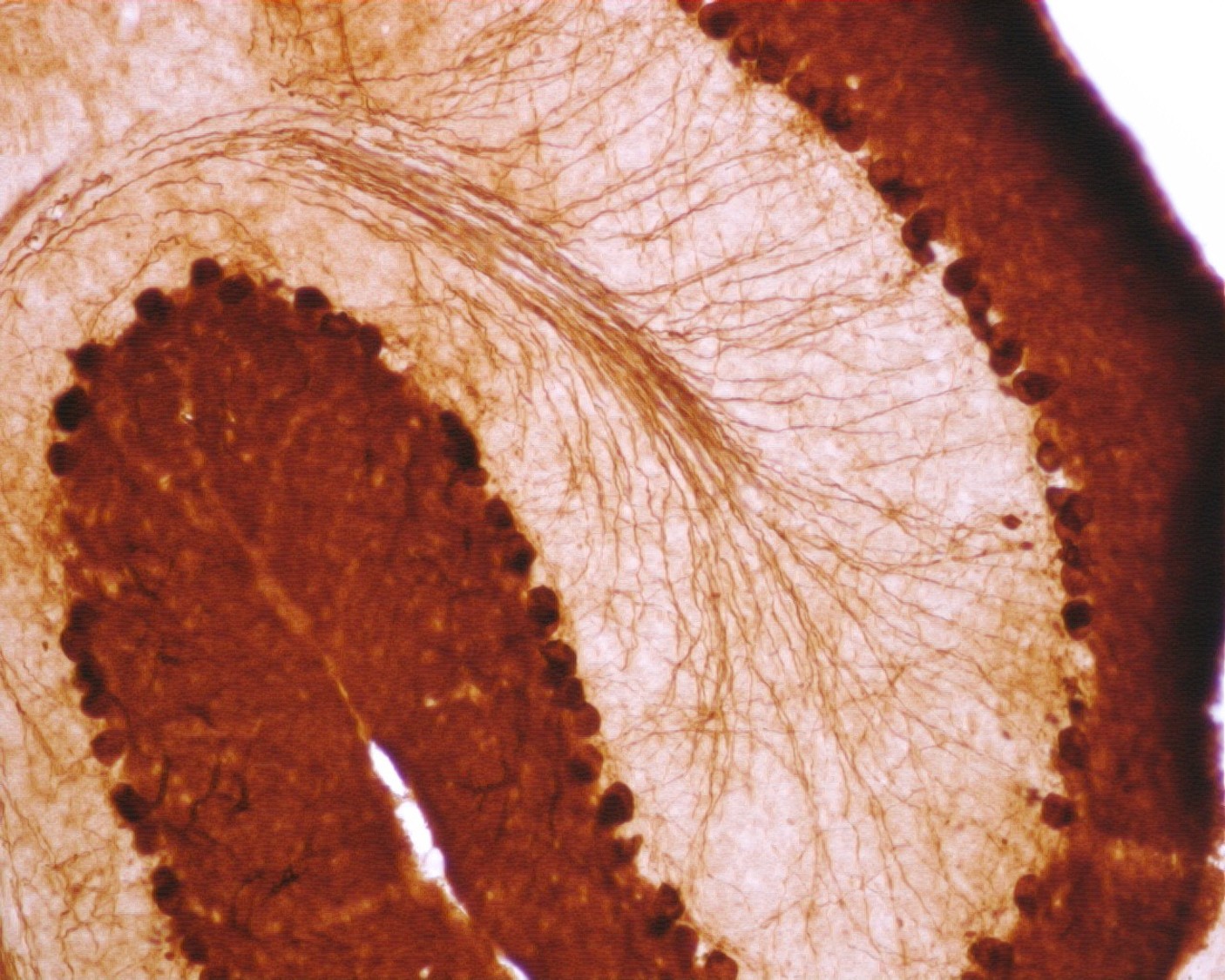 CB38a - Calbindin-500uL