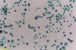 96-Well Leukocyte Endothelium Adhesion Assay