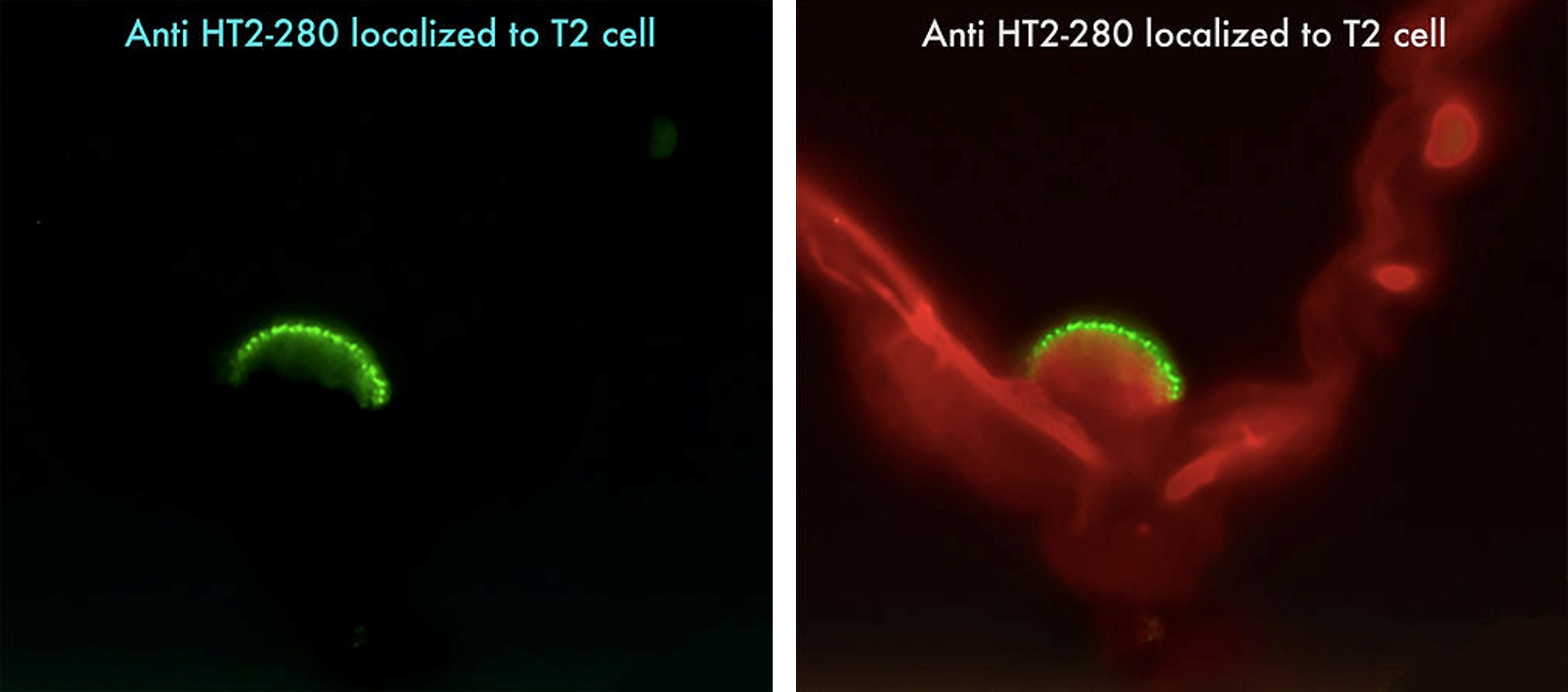 Anti HT2-280 1ml
