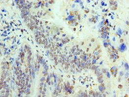 THOC1 Antibody