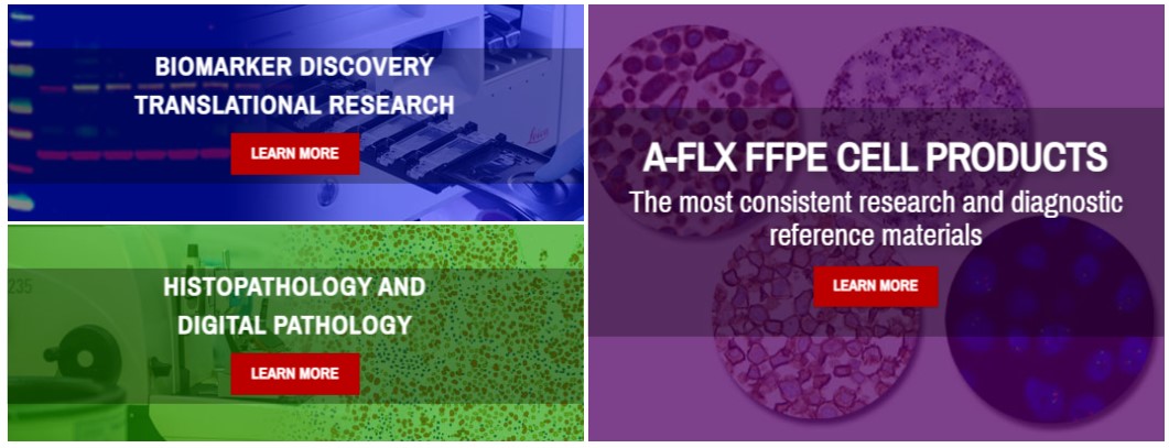 Acepix를 대표하는 이미지