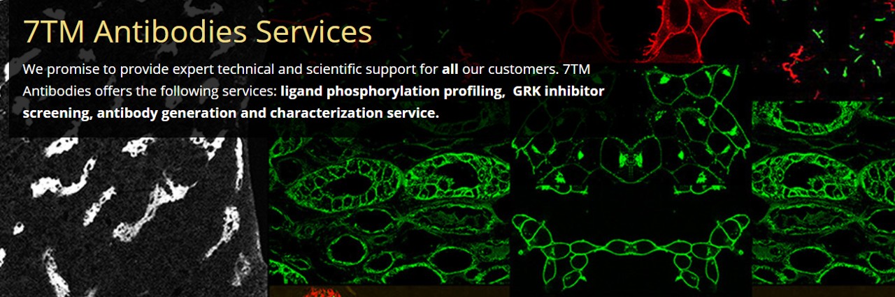 7TM Antibodies를 대표하는 이미지